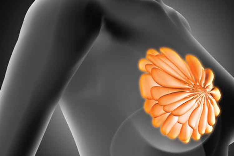 乳腺囊肿是怎么回事？